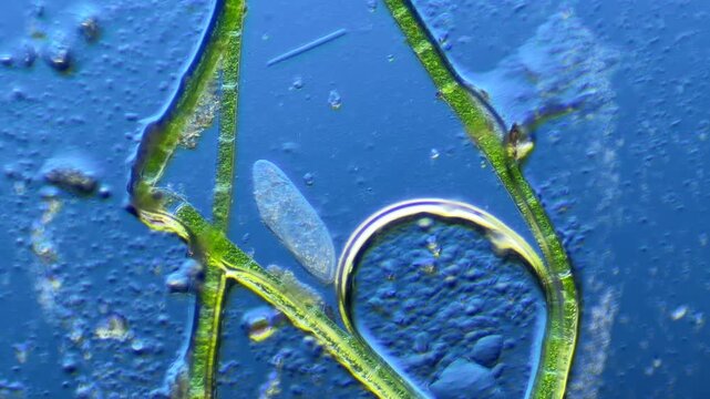 Paramecium and other microorganisms under the microscope at 100x Magnification