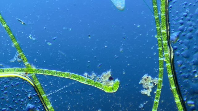 Paramecium and other microorganisms under the microscope at 100x Magnification