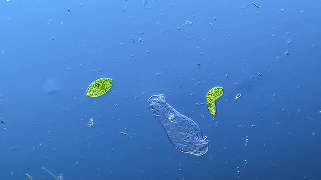 Euglenids and other microorganisms under the microscope at 100x Magnification
