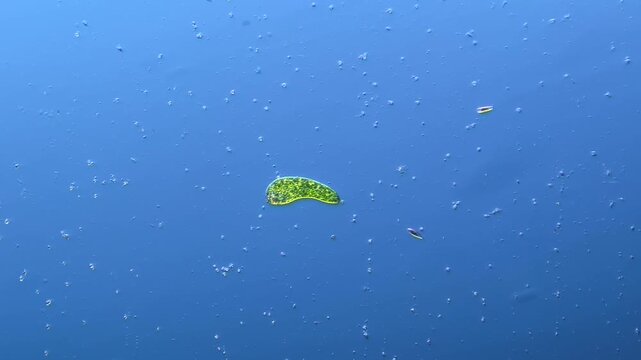 Euglenids and other microorganisms under the microscope at 100x Magnification