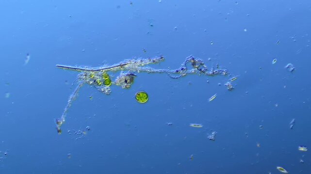 Euglenids and other microorganisms under the microscope at 100x Magnification