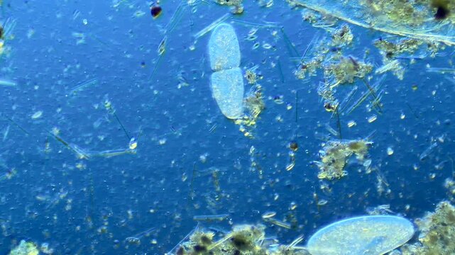 Euglena and other microorganisms under the microscope at 100x Magnification