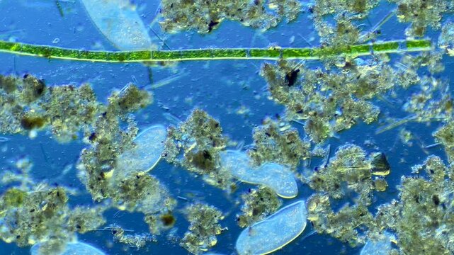 Numerous microorganisms under the microscope