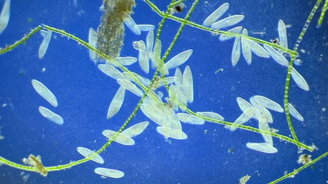 Numerous microorganisms under the microscope