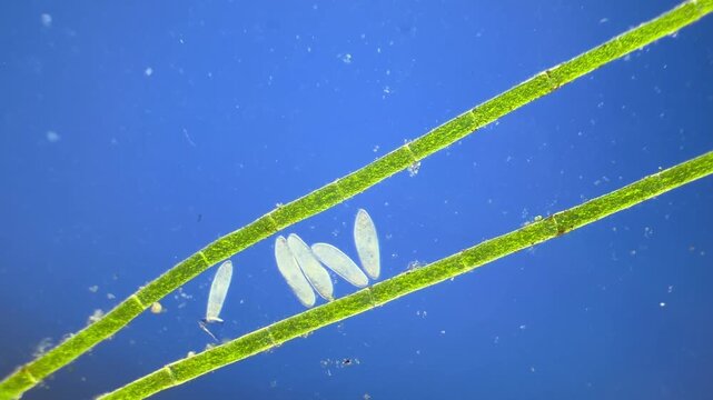 Numerous microorganisms under the microscope