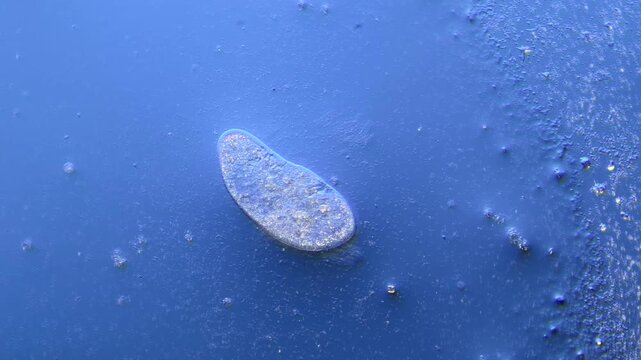 Paramecium and other microorganisms under the microscope at 100x Magnification