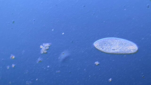 Paramecium and other microorganisms under the microscope at 100x Magnification