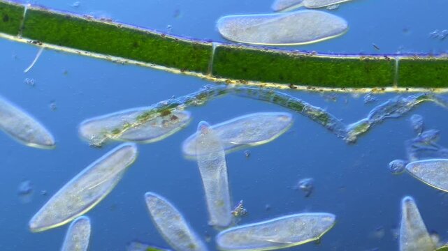 Paramecium and green algae under the microscope at 100x Magnification
