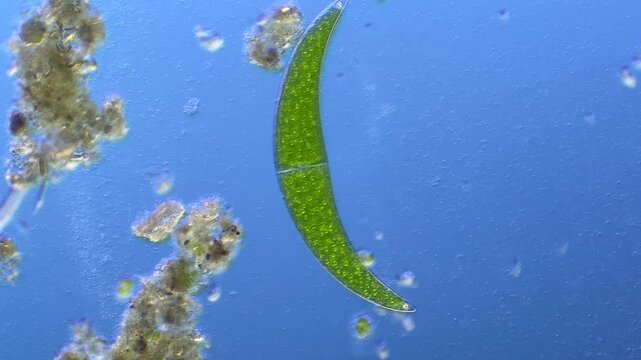 Paramecium and Closterium under the microscope at 100x Magnification