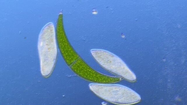 Paramecium and Closterium under the microscope at 100x Magnification