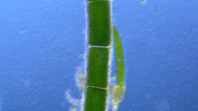 Paramecium and Closterium under the microscope at 100x Magnification