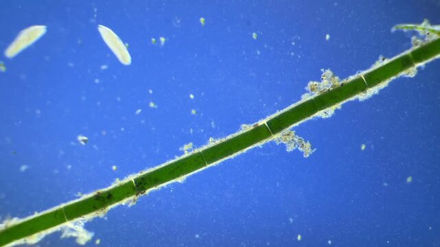 Large number of Paramecium under the microscope at 40x Magnification
