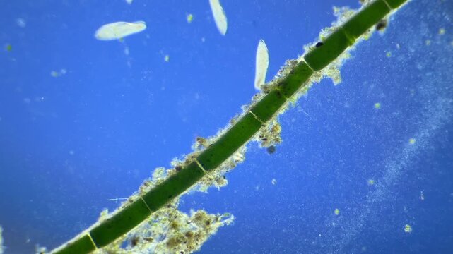 Large number of Paramecium under the microscope at 40x Magnification