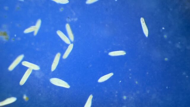 Large number of Paramecium under the microscope at 40x Magnification