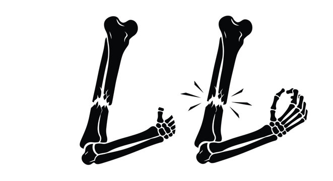 Broken bones and a hand offering support a symbol of healing