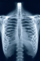 Human skeleton torso bones xray image of ribcage and spine transparent background
