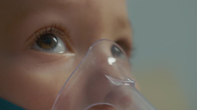 Child breathes in medicine through a mask connected to a nebulizer at home. This method helps treat respiratory infections like pneumonia with saline solution.