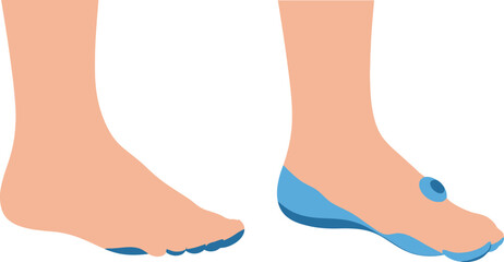 Stylish foot illustrations with blue accents on toes