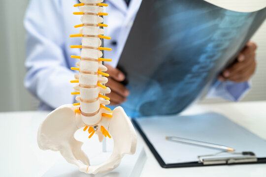 Doctor examining spine bone radiography xray film.