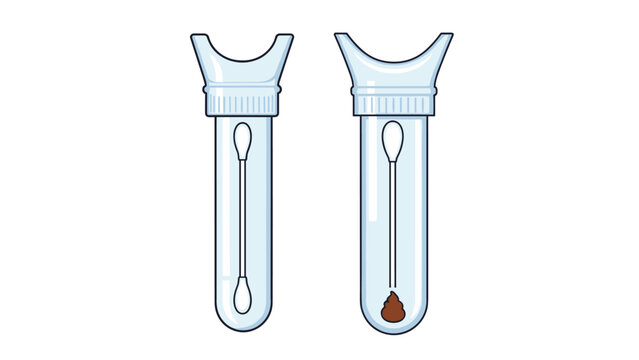 Medical illustration of two transparent laboratory test tubes with long swabs, one containing a brown stool sample for testing.