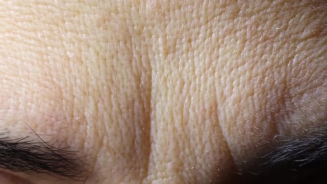 Wrinkles between eyebrows of a woman forming and smoothing. Concept of natural aging skin texture after forty. Close-up of facial expression detail.