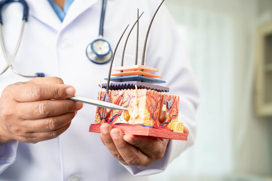 Hair transplant, Asian dermatologist doctor holding skin structure anatomy model for treatment in hospital.