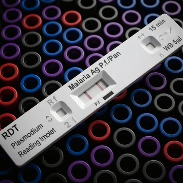 Close-up view of a malaria rapid diagnostic test showing positive results