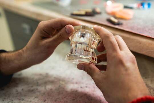 A dental technician creates a denture model in a dental office.