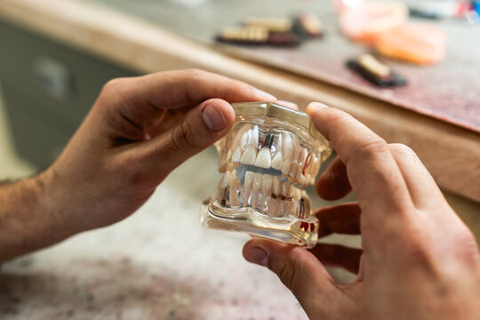 A dental technician creates a denture model in a dental office.