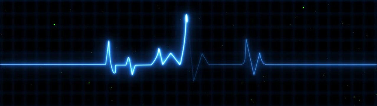 Blue E C G heartbeat line graph on dark background with grid pattern and green dots electrocardiogram