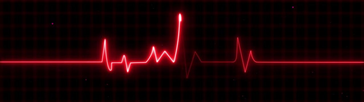 Red E C G heartbeat line graph on black background with grid pattern medical technology concept electrocardiogram