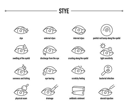 Stye symptoms, diagnostic and treatment vector icon set