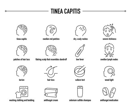 Tinea Capitis symptoms, diagnostic and treatment vector icon set