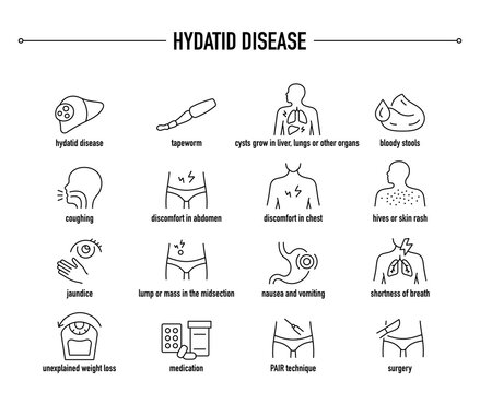 Hydatid Disease symptoms, diagnostic and treatment vector icon set