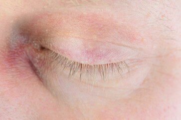 Obraz premium Extreme close-up of a closed human eye with visible eyelashes and delicate skin texture
