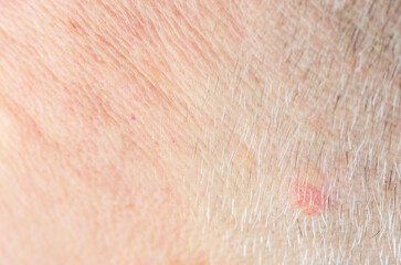 Fototapeta premium Extreme close-up macro shot of aged human skin texture with fine wrinkles and white hairs