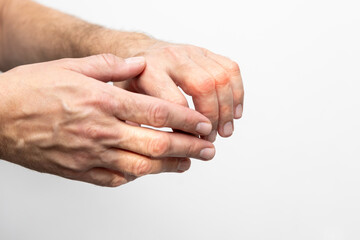 Hand pain, close-up of male hands on a white background
