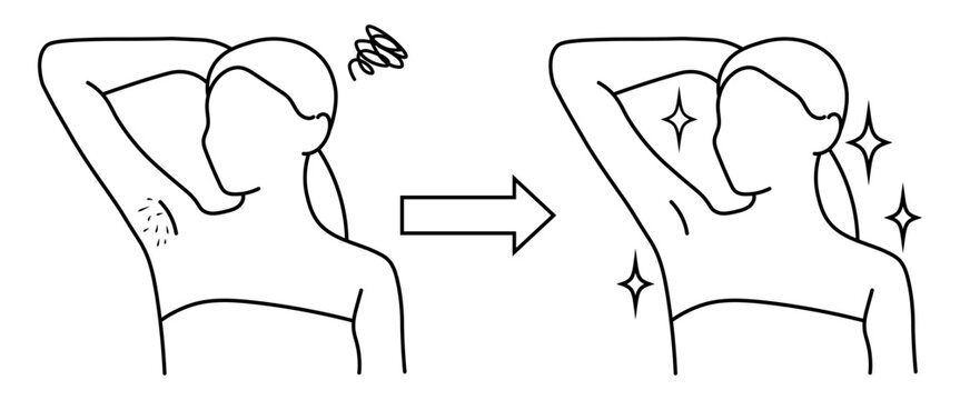 女性の脇脱毛ビフォーアフターの線画イラスト