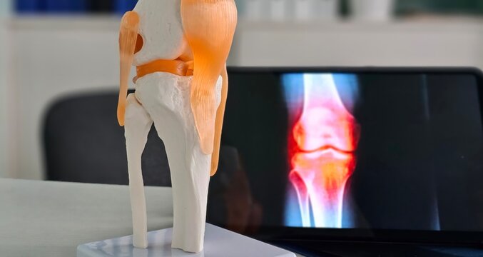 Model of a human knee joint with highlighted MRI scan displayed on a screen