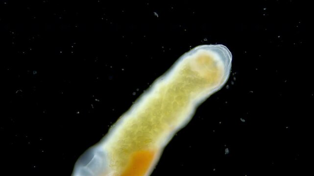 Parasitic worm Progonus muelleri under a microscope, at metacercaria stage. Class Trematoda. White Sea