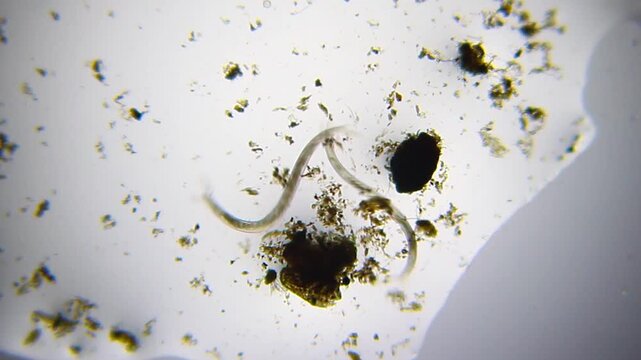 Two nematodes moving side by side under 40x brightfield microscopy. 4K scientific footage showing worm movement in a shared microenvironment.