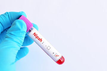 Obraz premium Blood sample tube positive with Nipah virus test