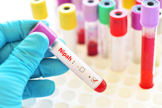 Blood sample tube positive with Nipah virus test