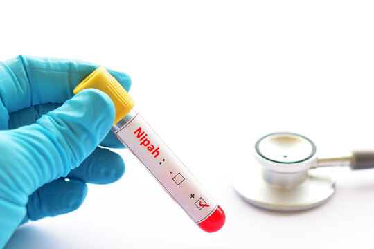Blood sample tube positive with Nipah virus test