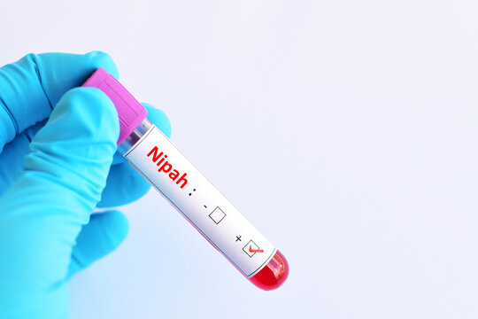 Blood sample tube positive with Nipah virus test