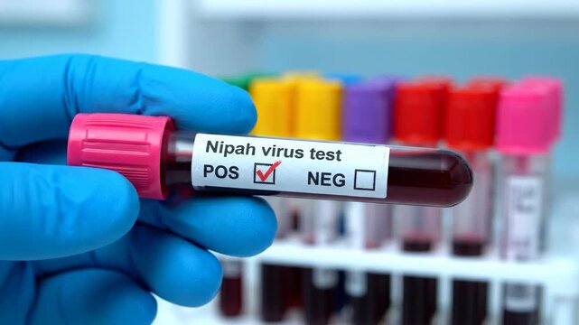 A laboratory technician holds a test tube labeled Nipah virus test with a positive result. Colorful test tubes are visible in the background, indicating medical research