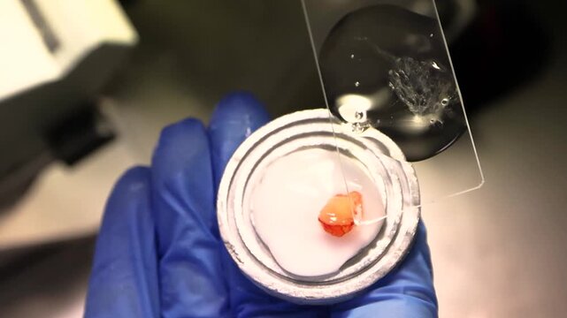 Close up view of biological specimen being prepared on thin glass slide by doctor wearing blue gloves for medical microscopic analysis in research diagnostics and clinical studies