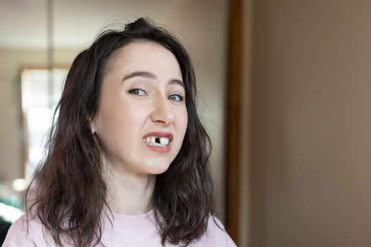 Mature Caucasian brunette woman missing a front tooth.