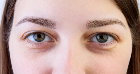 Naklejka premium Young girl after treatment, eyebrow correction on gray background.