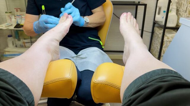 Close-up foot pedicure with electric file, podiatrist wearing blue gloves performs hardware debridement of thick fungal toenails in clinical salon, diabetic foot precautions observed, sterile.
